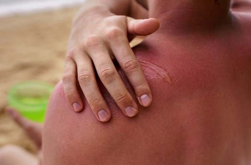 The Galveston Island Warning, Why Open Wounds and Brackish Surf Are a Lethal Combination